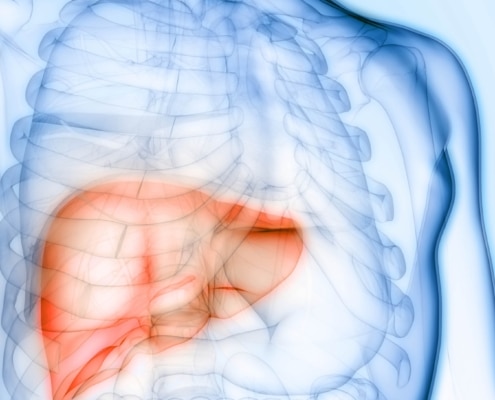 protect your liver